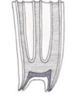 <p>__________ are high crowned molars for mammals that eat abrasive foods (Ex: Horses)</p>