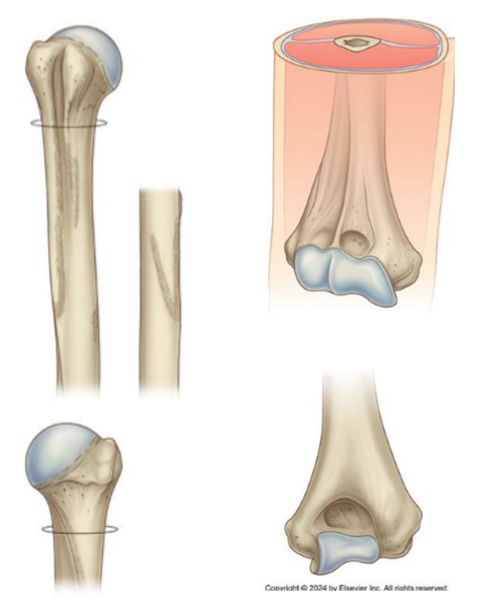 <p>What is significant about the medial epicondyle?</p>