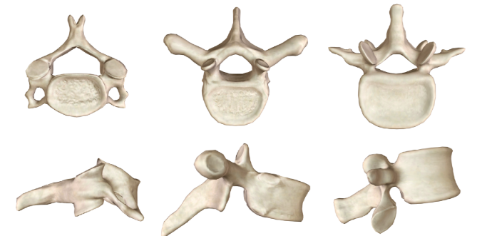 <p>Identify each vertebrae</p>
