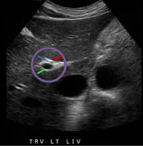 <p>What structure is indicated by the green arrow?</p>