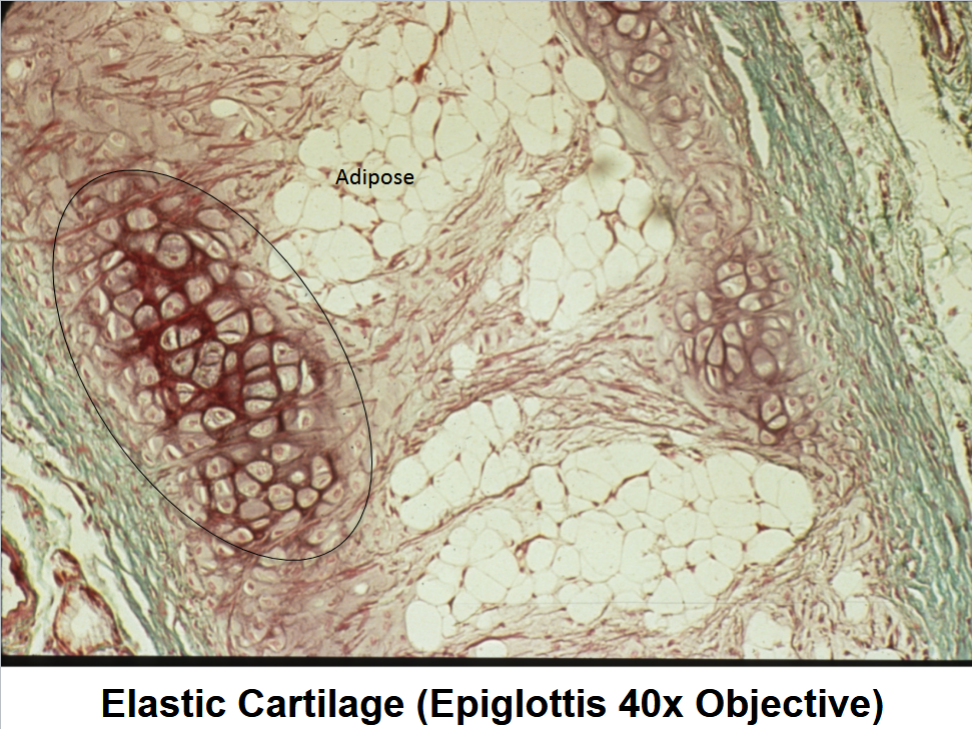 <p>epiglottis 40x objective</p>
