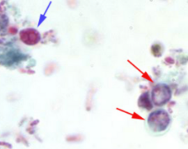 <p>Blue arrow: __________red arrow :________ (genus and stage for the ones that apply)</p>