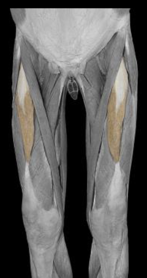 <p>innervation of rectus femoris</p>