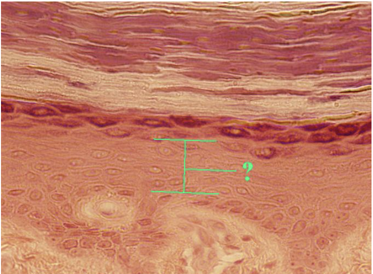 <p><span>Identify the indicated layer of thick skin.</span></p>