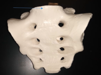 <p>What this bone called?</p>