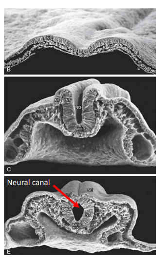 <p>Label the following:</p><ul><li><p>Neural Plate</p></li><li><p>Surface Ectoderm</p></li><li><p>Intraembryonic Mesoderm</p></li><li><p>Endoderm</p></li><li><p>Notochord</p></li><li><p>Neural Fold</p></li><li><p>Neural Groove</p></li><li><p>Neural Tube</p></li></ul><p></p>