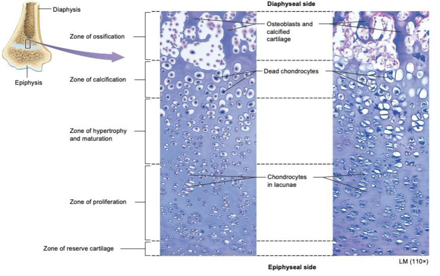 <p>Diaphyseal side</p><ul><li><p>zone of ossification</p><ul><li><p>osteoblasts and calcified cartilage</p></li></ul></li><li><p>zone of calcification</p><ul><li><p>dead chondrocytes</p></li></ul></li><li><p>zone of hypertrophy and maturation</p></li><li><p>zone of proliferation</p><ul><li><p>chondrocytes in lacunae</p></li></ul></li><li><p>zone of reserve cartilage</p></li></ul><p>epiphyseal plate</p><p></p>