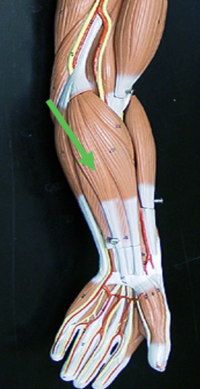<p>Identify the muscle indicated by the pointer.</p>