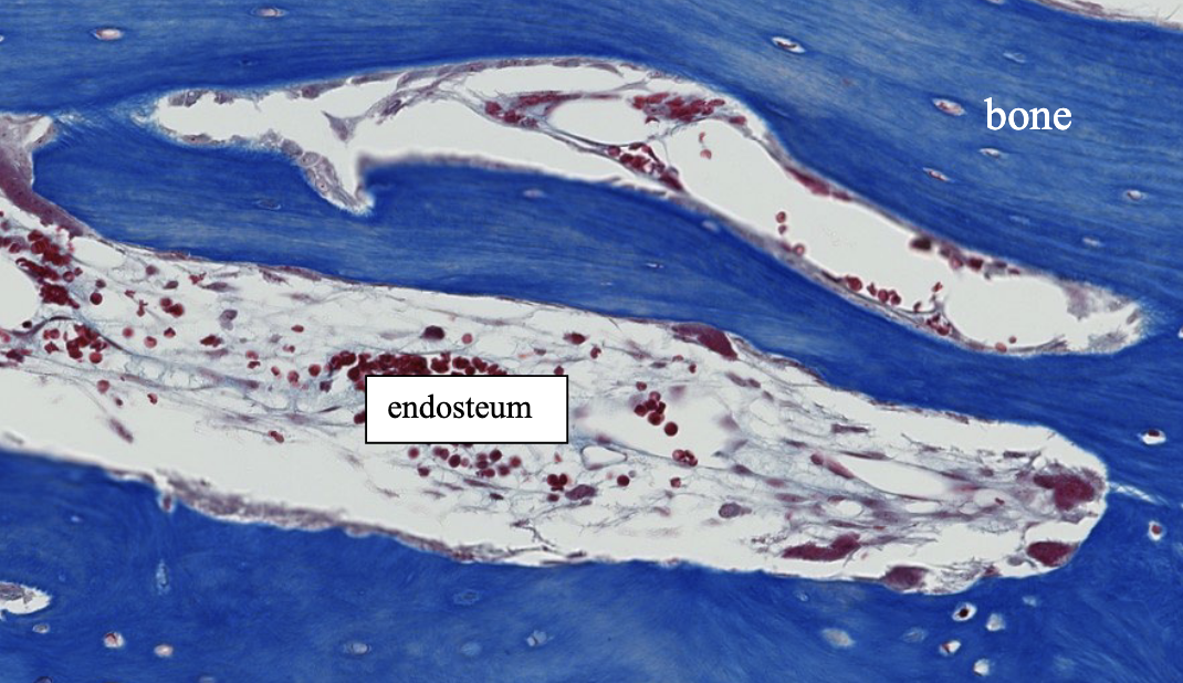 <p>what type of CT do you see in the endosteum (note: bone marrow not very cellular makes it visible, usually not)?</p>