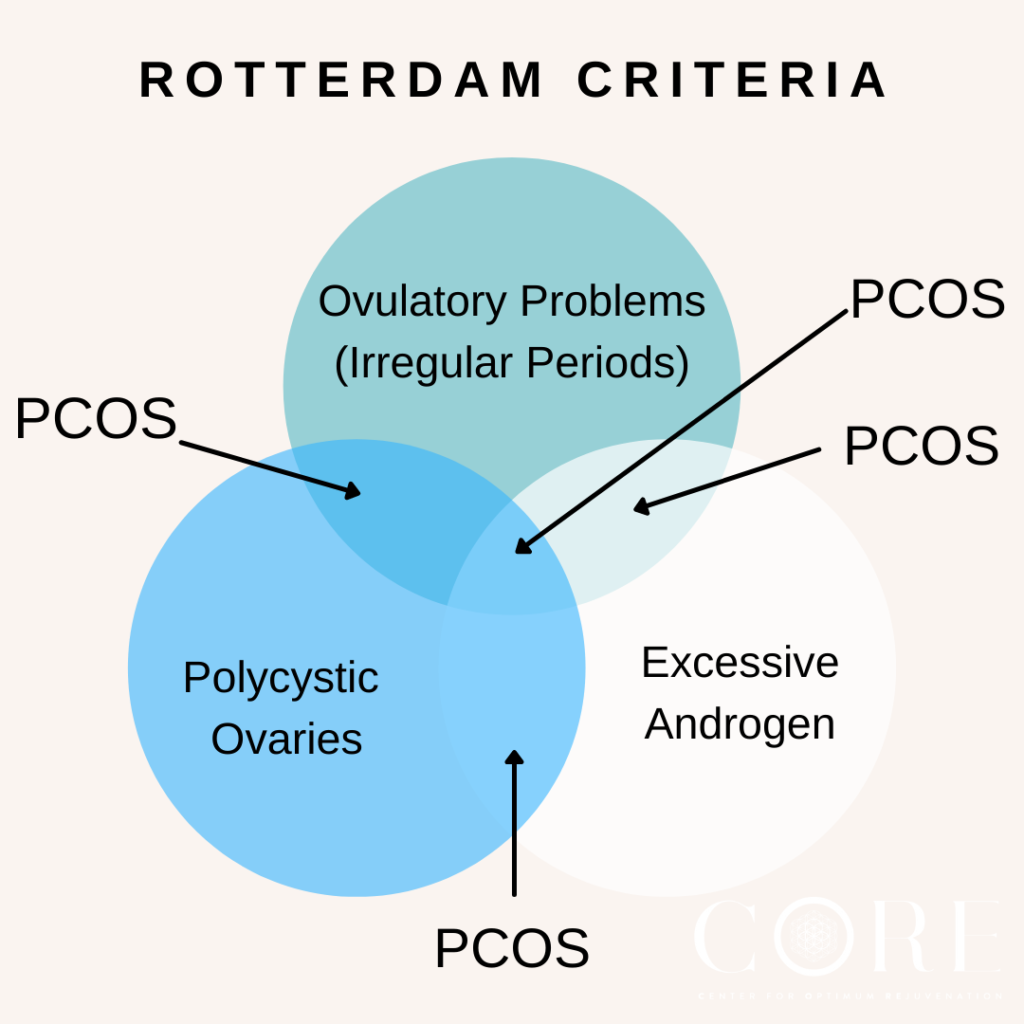 <p><strong>Diagnosis: Polycystic ovary syndrome (PCOS)</strong></p><p><strong>Key clues</strong></p><ul><li><p>Infertility from <strong>chronic anovulation</strong></p></li><li><p>Irregular, long cycles: <strong>every 35–50 days</strong></p></li><li><p><strong>Obesity</strong></p></li><li><p><strong>Acne</strong> = clinical hyperandrogenism</p></li><li><p>Normal TSH, LH, FSH, testosterone, and DHEAS <strong>do not exclude PCOS</strong></p></li></ul><p><strong>Flashcard takeaway:</strong><br>Reproductive-age woman with <strong>oligomenorrhea + signs of androgen excess + infertility</strong> → think <strong>PCOS</strong>, even when serum androgen levels are normal.</p><p>Need 2 out of the 3 rotterdam criteria </p><p></p>