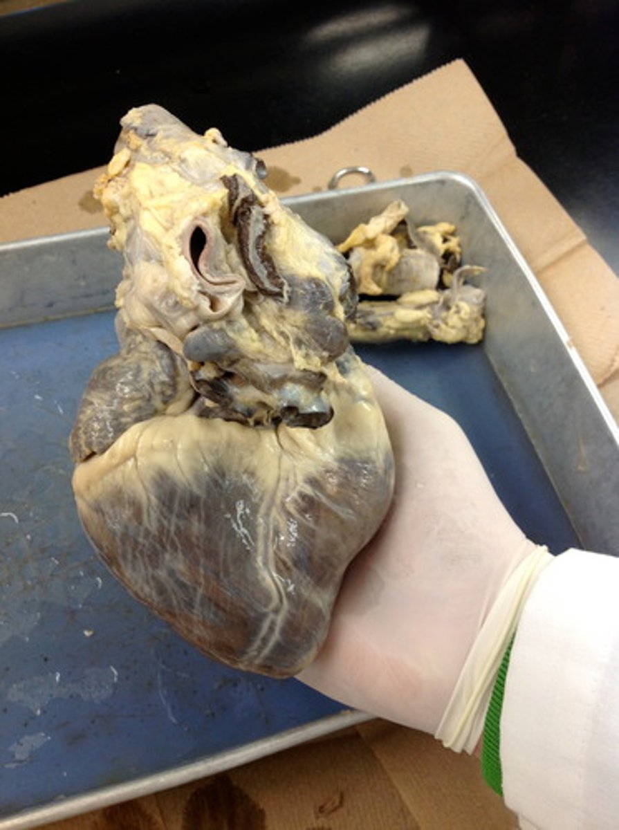 <p>Which View is this heart presenting?</p>
