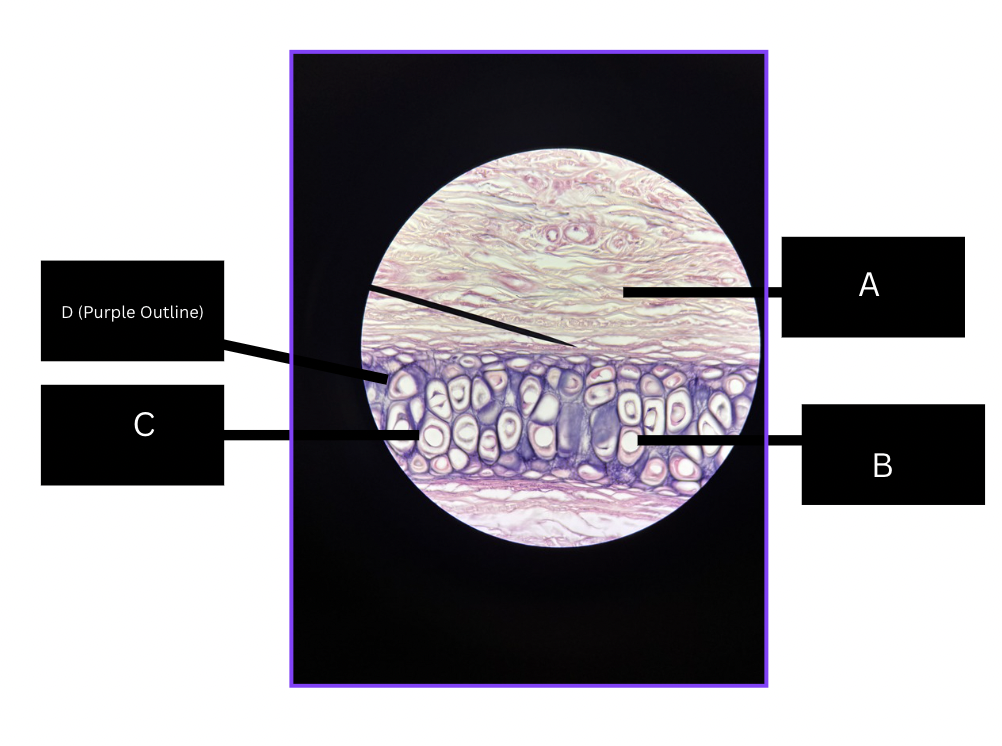 <p>describe structure of Elastic cartilage </p>