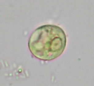 <p>Identifique e cite o habitat desse protozoário no ser humano</p>