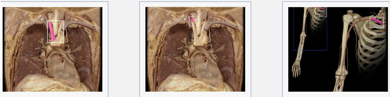 <p>Brachiocephalic trunk, right common carotid artery, right subclavian artery </p>