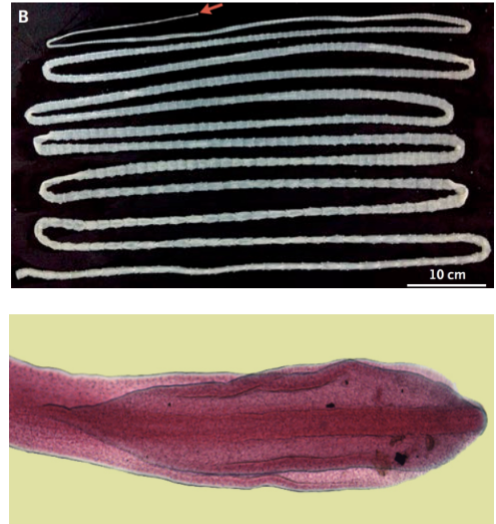 <ul><li><p>Mode of Transmission: Eat fish with cysticerci</p></li></ul><p>• Infective Stage: cysticerci</p><p>• Host: D- human, I-fish</p>