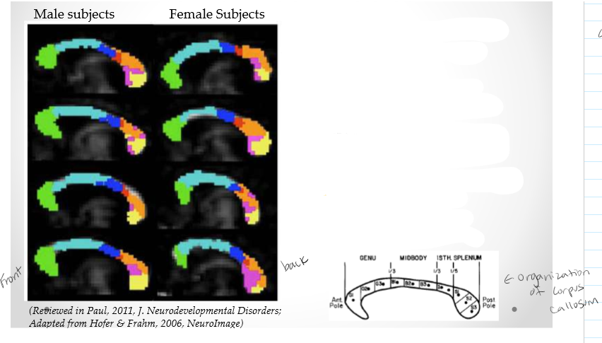 <p><span>Functional maps of the CC (slightly modified from earlier studies):<br>• Green: Prefrontal lobe<br>• Light Blue: Premotor &amp; supplementary motor areas<br>• Dark Blue: Primary motor cortex<br>• Red: Primary Sensory cortex<br>• Orange: Parietal lobe<br>• Violet: Temporal lobe<br>• Yellow: Occipital lobe</span></p><p><span>Not that much is different between male and female</span></p>