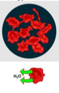 <p>solution has a higher concentration of solute then cell</p>
