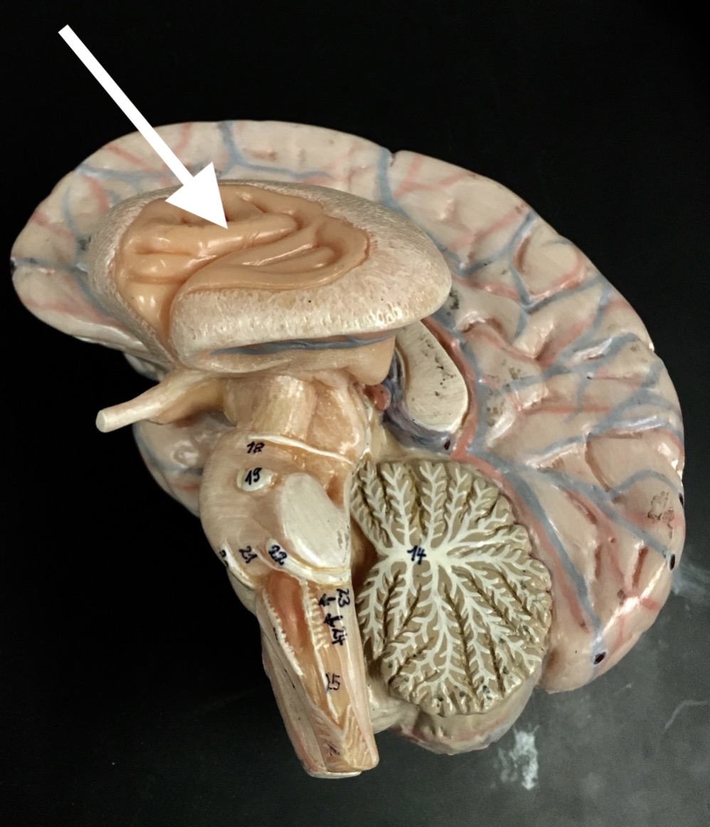 <p>What is the arrow pointing to?</p>