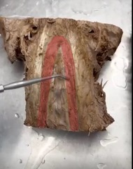 <p>Name the muscle</p>