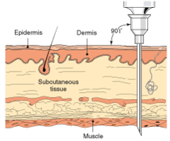<p>Needle placed in the middle of a large muscle. Needle is administered 90 degree angle to the skin</p>