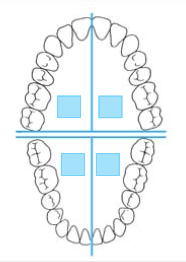 <p>What are the different quadrants?</p>