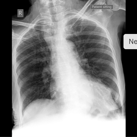 <p>What bandaging technique should be used for this injury?</p>