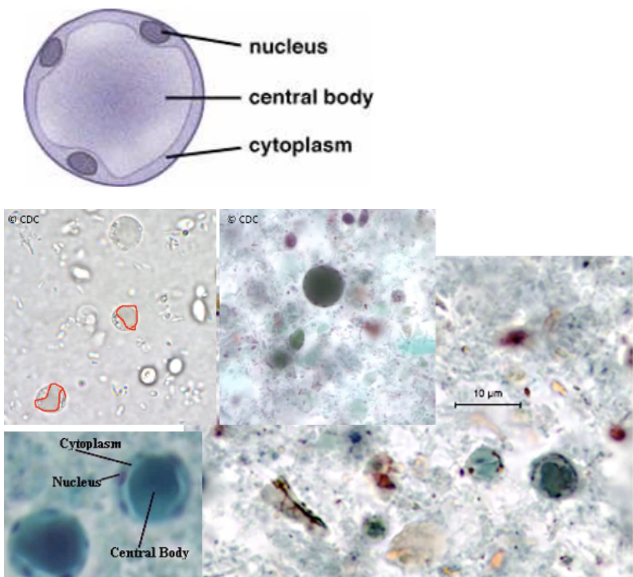 <p>Trophozoite</p><ul><li><p><span style="background-color: transparent;">Nucleus = 2-6</span></p></li><li><p><span style="background-color: transparent;">Cyst-like structure</span></p></li><li><p><span style="background-color: transparent;">5-30 um</span></p></li><li><p><span style="background-color: transparent;">Large central body</span></p></li></ul><p>Clinical Significance</p><ul><li><p><span style="background-color: transparent;">Can cause gastrointestinal disease in travelers and AIDS patients</span></p></li><li><p><span style="background-color: transparent;">typically commensal and non-pathogenic</span></p></li><li><p><span style="background-color: transparent;">spread fecal-oral</span></p></li></ul><p></p>