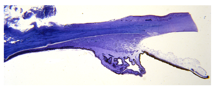 <p>identidy the structures of the microscopic structures of the ciliary body</p>