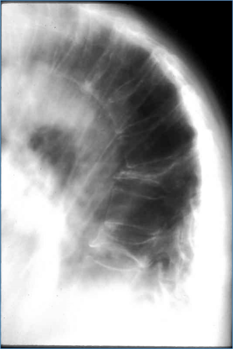 <p>What is the Dx or DDx?</p>