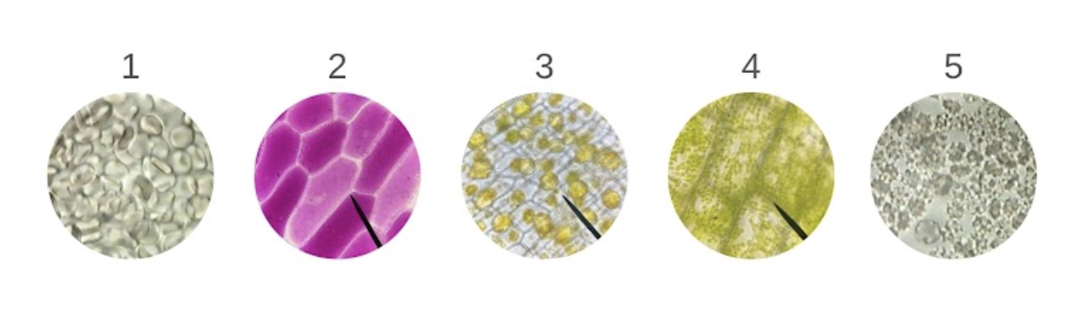 <p><span style="line-height: 1.5;">30. Observe the micrographs below. Which of the following micrographs represents a cell in a hypertonic solution?<br></span></p><p><span style="line-height: 1.5;">A. 1 and 2</span></p><p><span style="line-height: 1.5;">B. 3 and 5</span></p><p><span style="line-height: 1.5;">C. 2 and 4</span></p><p><span style="line-height: 1.5;">D. 3 and 4</span></p>