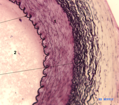 <p>what would be the epithelium of this structure histologically?</p>