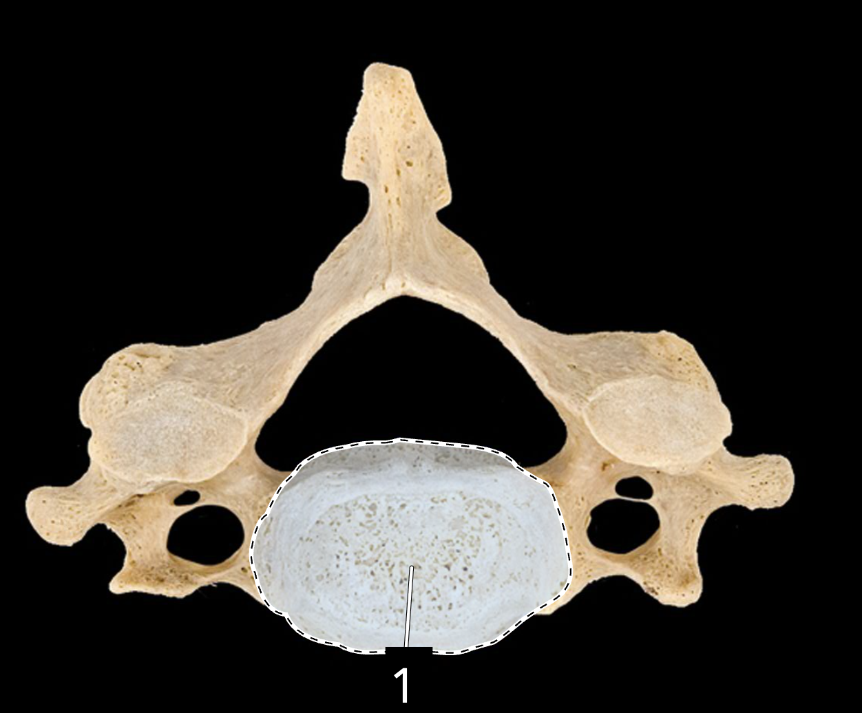 <p>What type of bone is this?</p>