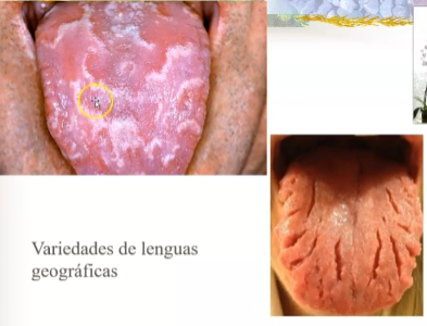 term image