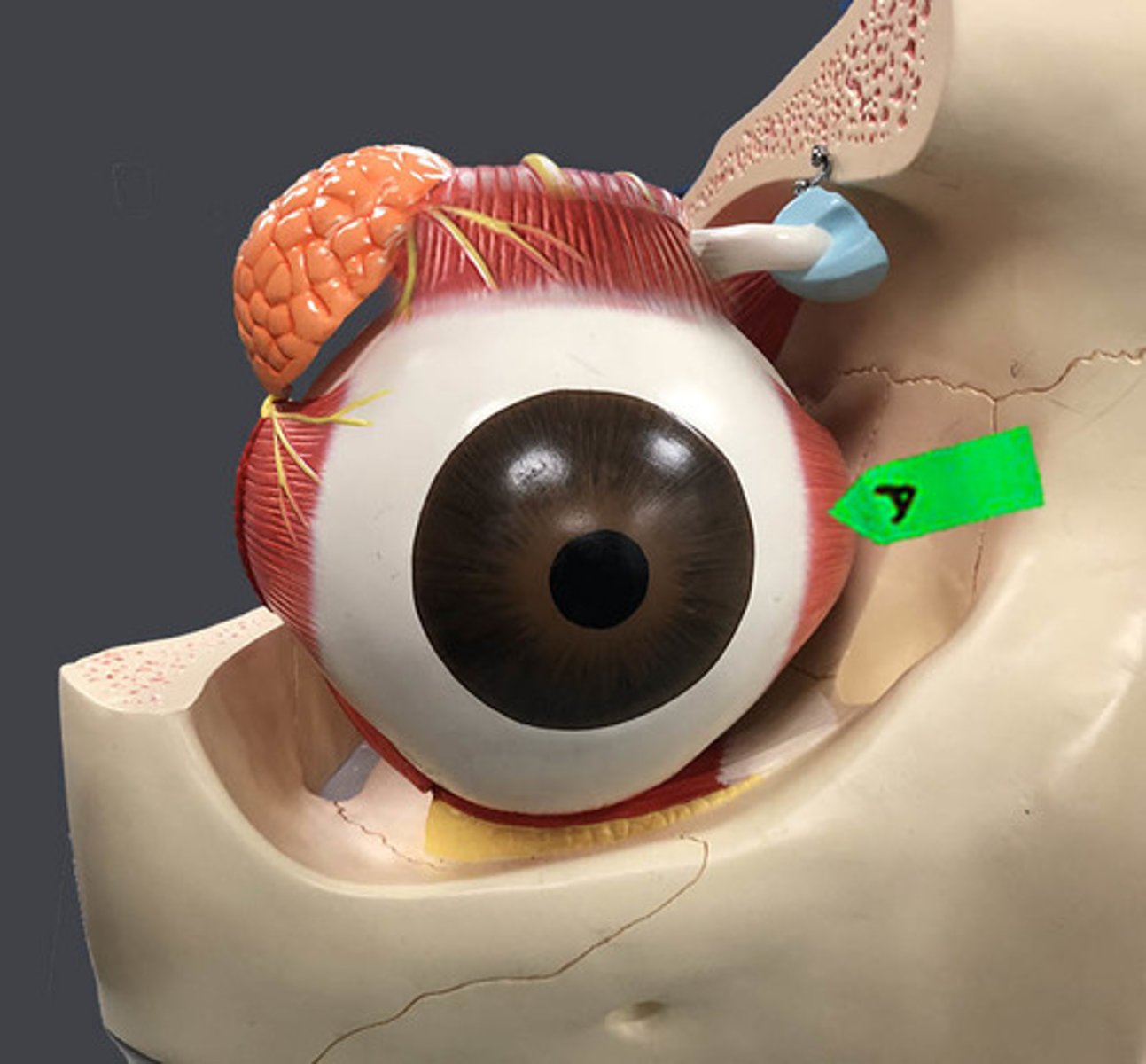 <p>Identify this muscle.</p>