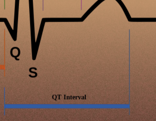 <p>QT interval</p>