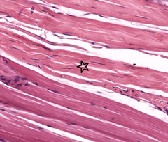 <p>What type of connective tissue is indicated by the star?</p>