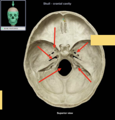 <p>What major opening is the highlighted arrow pointing to? (SUPERIOR VIEW)</p>