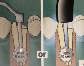 <p>You can either light cure it for 40 seconds, or let it set for 6 minutes</p>