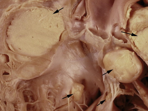 <p>HEART AND LUNGS</p>