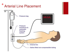 <p>arterial line</p>