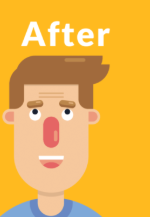 <p>After</p>