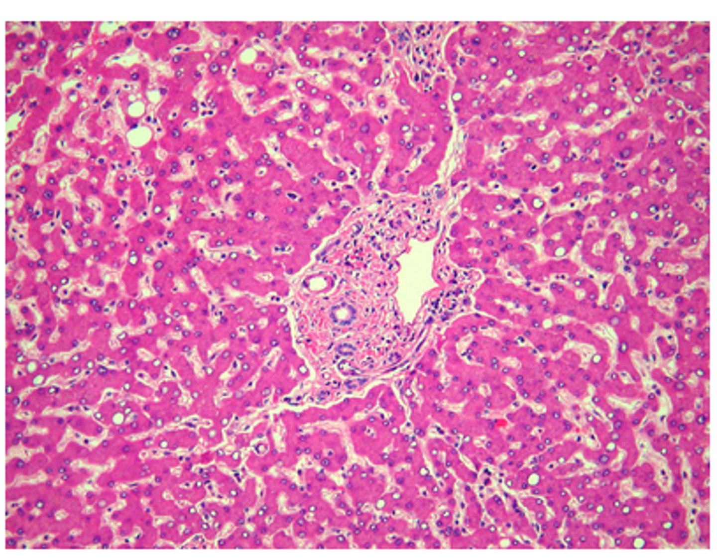 <p>liver</p><p>Feedback:</p><p>This tissue can be identified as liver by the cords of hepatocytes and by the portal triad in the center of the image.</p>