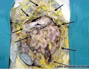 <p>which artery is being indicated by the arrows?</p>