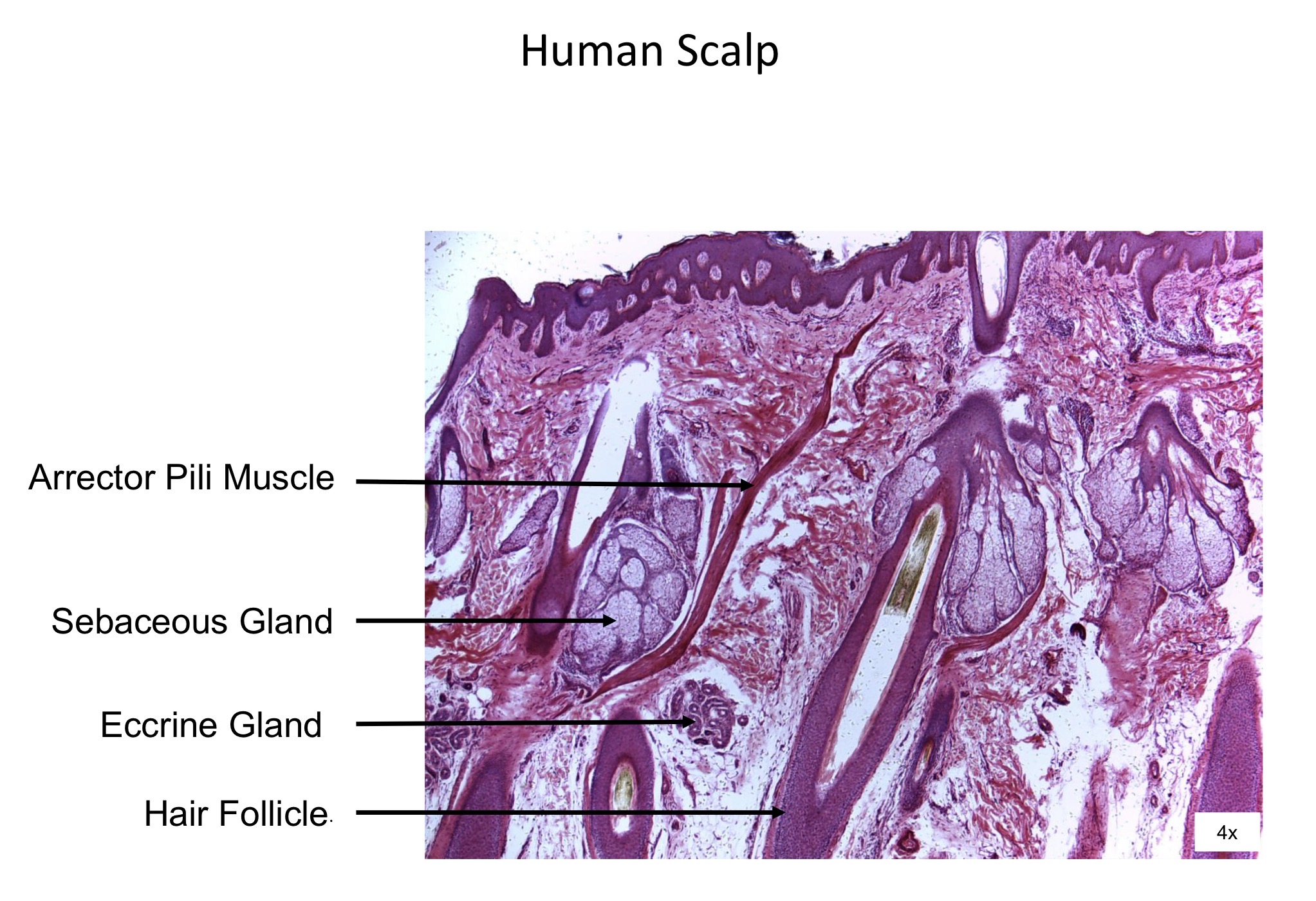 <ol><li><p>Arrector Pili muscle </p></li><li><p>Sebaceous gland</p></li><li><p>Eccrine gland </p></li><li><p>Hair follicle </p></li></ol><p></p>