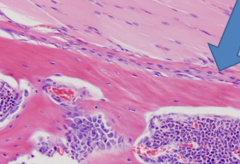 <p>Identify bone layer</p>