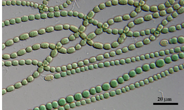 <p>Anabaena (cyanobacteria);</p>