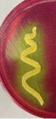 <p><strong><mark data-color="yellow" style="background-color: yellow; color: inherit;">Yellow Colonies</mark></strong>/Agar on MSA:</p>