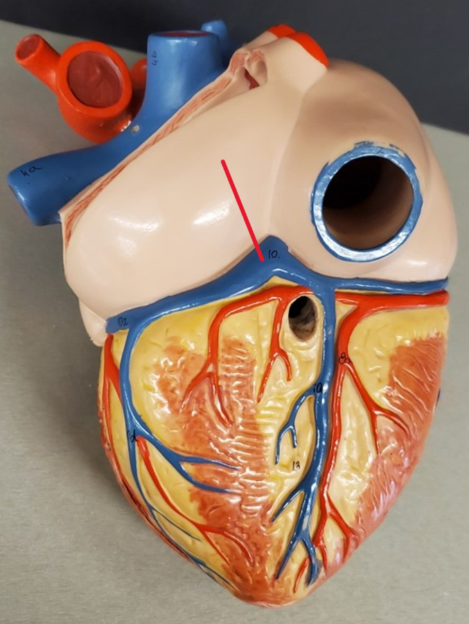 <p>Name the vein</p>