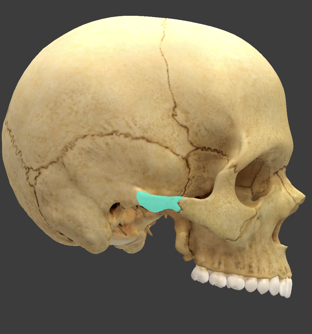term image