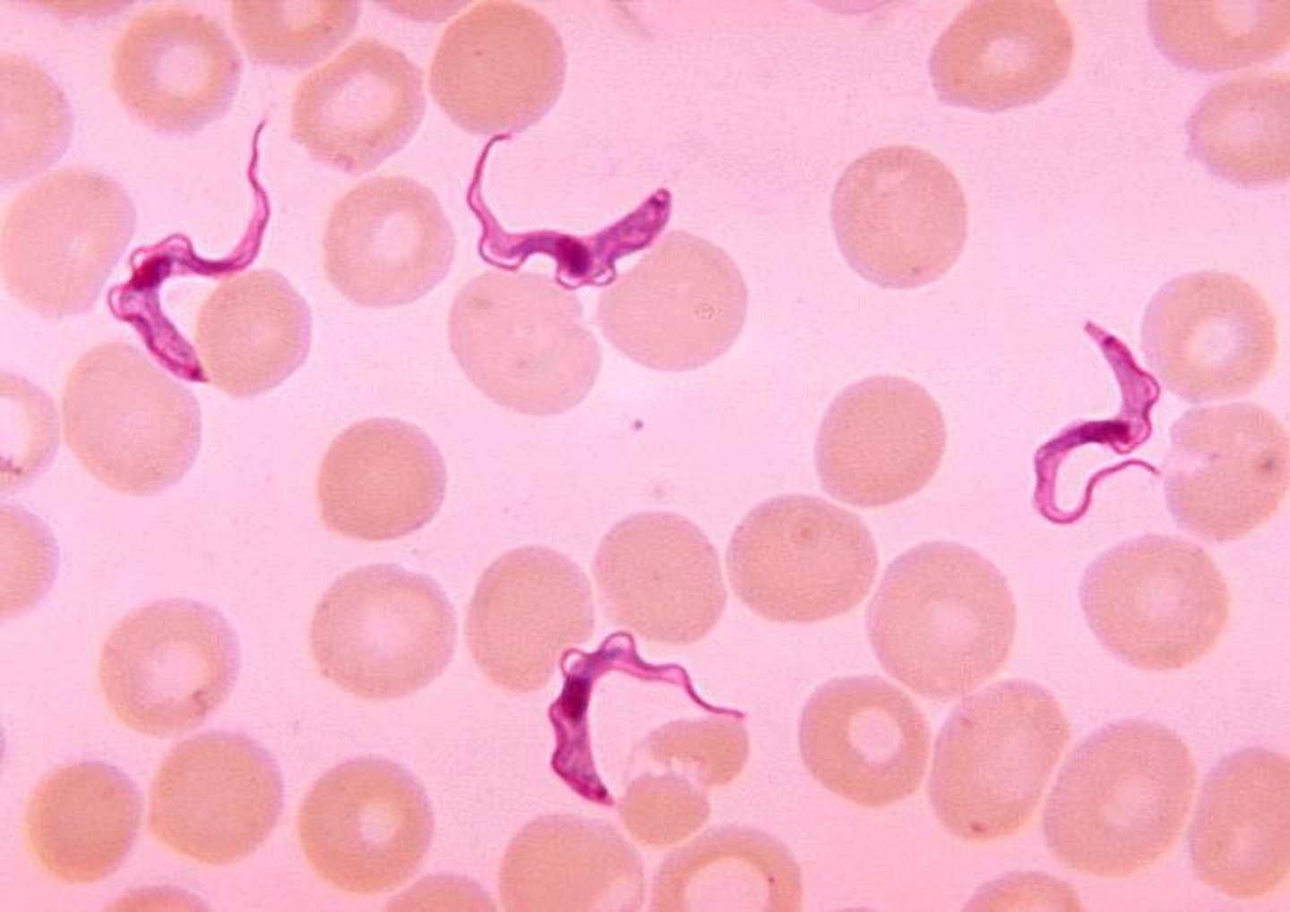 <p>Trypanosomes & Euglenids</p>